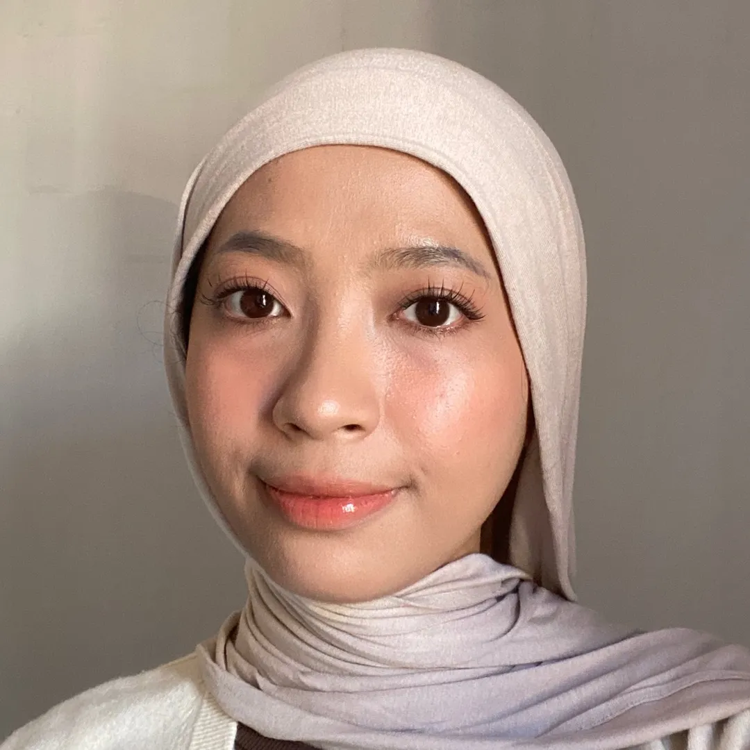 aldamputri